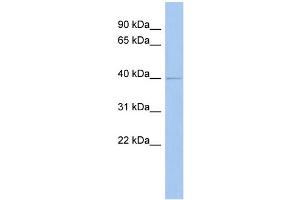 WB Suggested Anti-ZADH2 Antibody Titration: 0. (ZADH2 抗体  (N-Term))