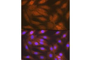 Immunofluorescence analysis of C6 cells using RAIDD/CRADD Rabbit mAb (ABIN7266106) at dilution of 1:100 (40x lens). (CRADD 抗体)