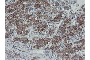 Image no. 7 for anti-Mitochondrial Ribosomal Protein S27 (MRPS27) (AA 151-414) antibody (ABIN1490963)