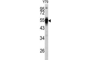 Western Blotting (WB) image for anti-Protein Disulfide Isomerase Family A, Member 6 (PDIA6) antibody (ABIN3002737) (PDIA6 抗体)