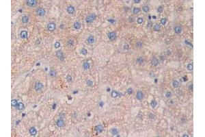 DAB staining on IHC-P; Samples: Human Liver Tissue. (CYFRA21.1 抗体  (AA 244-400))