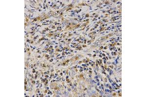 Immunohistochemistry (IHC) image for anti-Cathelicidin Antimicrobial Peptide (CAMP) (AA 31-170) antibody (ABIN3022306) (Cathelicidin 抗体  (AA 31-170))