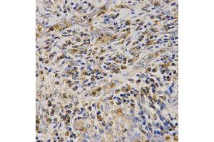 Immunohistochemistry (IHC) image for anti-Cathelicidin Antimicrobial Peptide (CAMP) (AA 31-170) antibody (ABIN6218724) (Cathelicidin 抗体  (AA 31-170))