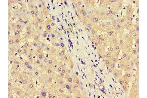 Immunohistochemistry of paraffin-embedded human liver tissue using ABIN7144599 at dilution of 1:100 (ASS1 抗体  (AA 168-222))