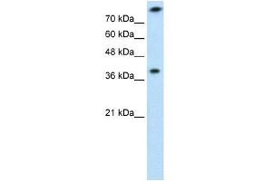 TST antibody used at 1 ug/ml to detect target protein. (TST 抗体)