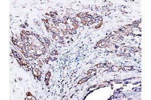 IHC analysis of ORP150/HYOU1 using anti-ORP150/HYOU1 antibody (ABIN7601807). (HYOU1 抗体  (AA 46-913))