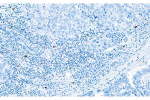 Immunohistochemistry (IHC) image for anti-Granzyme B (GZMB) (AA 19-247) antibody (ABIN7449554) (Recombinant GZMB 抗体  (AA 19-247))