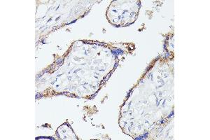 Immunohistochemistry of paraffin-embedded human placenta using LTF antibody (ABIN6131498, ABIN6143382, ABIN6143383 and ABIN6216705) at dilution of 1:100 (40x lens). (Lactoferrin 抗体  (AA 500-710))