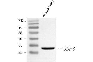 Western blot analysis of ODF3 using anti-ODF3 antibody (ABIN7600895).