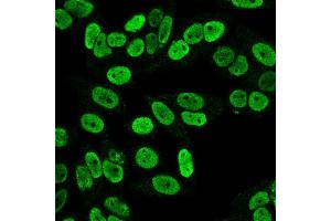 Immunofluorescence Analysis of PFA fixed HeLa cells labeling Cyclin B1 MAb (SPM619)followed by Goat anti-mouse IgG-CF488 (Green).