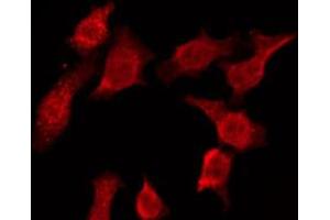 ABIN6274603 staining Hela by IF/ICC. (P-Cadherin 抗体  (N-Term))