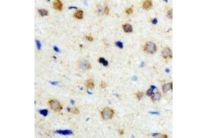Immunohistochemical analysis of ICK staining in human brain formalin fixed paraffin embedded tissue section. (ICK 抗体)