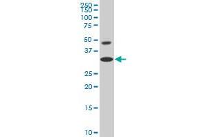HOXD8 monoclonal antibody (M03), clone 5E11 Western Blot analysis of HOXD8 expression in HepG2 . (HOXD8 抗体  (AA 126-190))