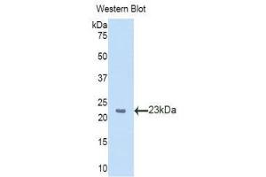 Western Blotting (WB) image for anti-Slit Homolog 2 (Drosophila) (SLIT2) (AA 31-197) antibody (ABIN1173401) (SLIT2 抗体  (AA 31-197))