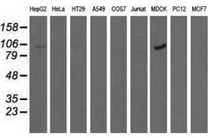 Western blot analysis of extracts (35 µg) from 9 different cell lines by using anti-ALDH1L1 monoclonal antibody. (ALDH1L1 抗体)