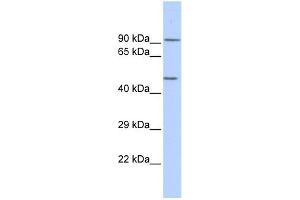 WB Suggested Anti-KCNJ8 Antibody Titration: 0. (KCNJ8 抗体  (Middle Region))