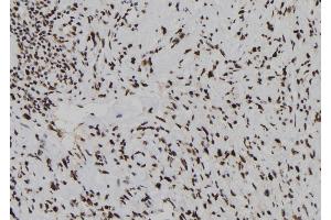 ABIN6278246 at 1/100 staining Human gastric tissue by IHC-P. (Dual Specificity Phosphatase 3 (DUSP3) (N-Term) 抗体)