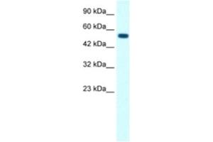 Western Blotting (WB) image for anti-Glycine Receptor, alpha 1 (GLRA1) antibody (ABIN2463727) (GLRA1 抗体)