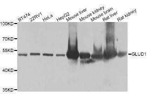 Western blot analysis of extracts of various cell lines, using GLUD1 antibody. (GLUD1 抗体  (AA 54-240))