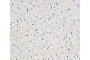 Immunohistochemistry of paraffin-embedded Rat heart using DMD Polyclonal Antibody at dilution of 1:100 (40x lens). (Dystrophin 抗体)