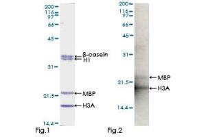 Kinase Activity Assay (KAA) image for Protein Kinase C, iota (PRKCI) (AA 1-587) protein (GST tag) (ABIN1316270) (PKC iota Protein (AA 1-587) (GST tag))