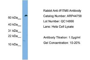 WB Suggested Anti-IFITM5  Antibody Titration: 0. (IFITM5 抗体  (Middle Region))