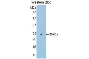 Western Blotting (WB) image for anti-N-Acetylgalactosaminidase, alpha (NAGA) (AA 18-217) antibody (ABIN1176641) (NAGA 抗体  (AA 18-217))