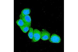 IF analysis of S100A4 using anti-S100A4 antibody (ABIN7600462). (s100a4 抗体  (AA 2-101))
