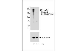 Western blot analysis of lysate from A431 cell line, using Phospho-HUN-PIK3C2B (ABIN6241073 and ABIN6578945). (PIK3C2B 抗体  (pTyr228))