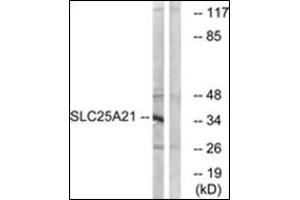 Western blot analysis of extracts from HepG2 cells, using SLC25A21 Antibody   The lane on the right is treated with the synthesized peptide.