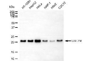 Western blotting analysis using UBE2M antibody (ABIN7800750).