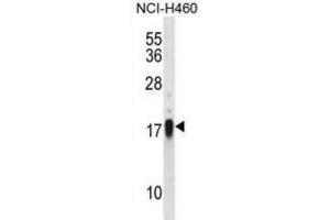 Western Blotting (WB) image for anti-CD70 Molecule (CD70) antibody (ABIN2998201) (CD70 抗体)