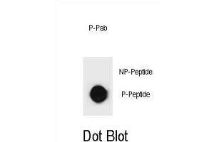 Dot blot analysis of KIT Antibody (Phospho ) Phospho-specific Pab (ABIN1881481 and ABIN2850471) on nitrocellulose membrane. (KIT 抗体  (pSer891))