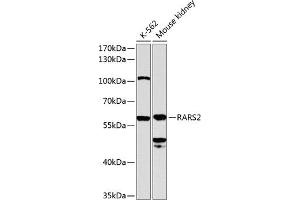 Western blot analysis of extracts of various cell lines, using R antibody (ABIN6129727, ABIN6146710, ABIN6146711 and ABIN6224588) at 1:1000 dilution. (RARS2 抗体  (AA 17-340))