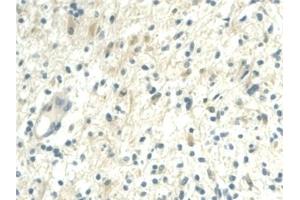 Immunohistochemistry (IHC) image for anti-Nicotinamide phosphoribosyltransferase (NAMPT) (AA 1-491) antibody (ABIN7432295)