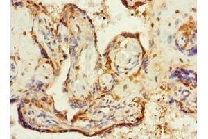 Immunohistochemistry of paraffin-embedded human placenta tissue using ABIN7176726 at dilution of 1:100 (ZP2 抗体  (AA 651-745))