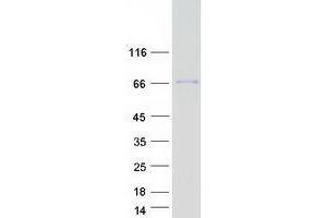 Western Blotting (WB) image for Solute Carrier Family 39 (Zinc Transporter), Member 4 (SLC39A4) (Transcript Variant 2) protein (Myc-DYKDDDDK Tag) (ABIN2735908)