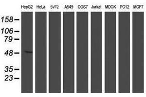 Image no. 2 for anti-Asparagine-Linked Glycosylation 2, alpha-1,3-Mannosyltransferase Homolog (ALG2) antibody (ABIN1496610) (ALG2 抗体)