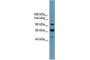 Image no. 1 for anti-Retinoblastoma Protein (Rb Protein) (C-Term) antibody (ABIN6744235) (Retinoblastoma Protein (Rb) 抗体  (C-Term))