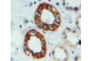 #VALUE! (Nephrin 抗体  (AA 27-234))