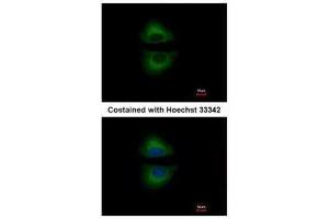 ICC/IF Image Immunofluorescence analysis of methanol-fixed A549, using GRAP, antibody at 1:500 dilution. (GRAP 抗体  (C-Term))