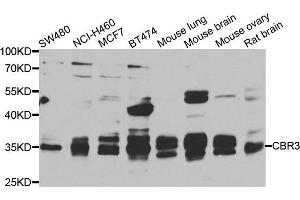 Western blot analysis of extracts of various cell lines, using CBR3 antibody. (CBR3 抗体)