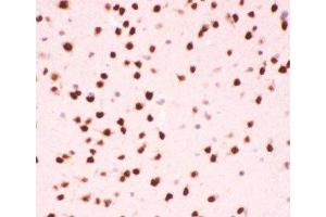 Immunohistochemistry (IHC) image for anti-Activating Transcription Factor 2 (ATF2) (AA 93-450) antibody (ABIN3029845)