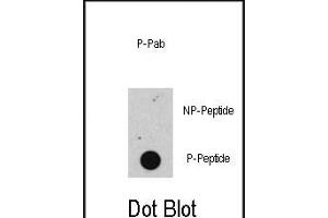 Dot blot analysis of anti-Phospho-RB- Antibody (ABIN389642 and ABIN2839634) on nitrocellulose membrane. (Retinoblastoma 1 抗体  (pSer608))