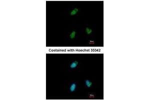 ICC/IF Image Immunofluorescence analysis of paraformaldehyde-fixed A549, using CLUAP1, antibody at 1:500 dilution. (CLUAP1 抗体)