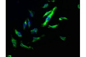 Immunofluorescence staining of U251 cells with ABIN7140173 at 1:200, counter-stained with DAPI. (TJP2 抗体  (AA 1165-1183))