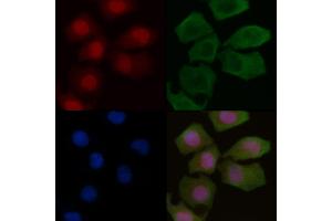 ABIN6256251 and ABIN6267221 staining Hela cells by IF/ICC.