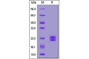 SDS-PAGE (SDS) image for Interleukin 11 (IL11) (AA 22-199) (Active) protein (His tag) (ABIN7013692)