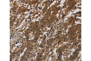 Immunohistochemistry (IHC) image for anti-Integrin beta 7 (ITGB7) antibody (ABIN2433217) (Integrin beta 7 抗体)