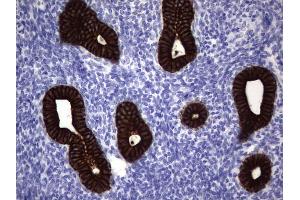 Immunohistochemistry (IHC) image for anti-Keratin Acidic (AE1) antibody (ABIN2715666)